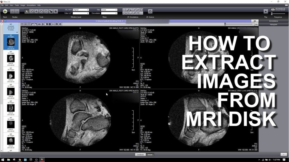 How to View Mri Cd on Windows 10? - keysdirect.us